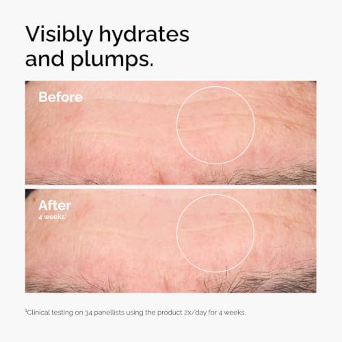 The Ordinary Hyaluronic Acid 2% + B5 (with Ceramides), Multi-Depth Hydration Serum for Plumper, Smoother Skin